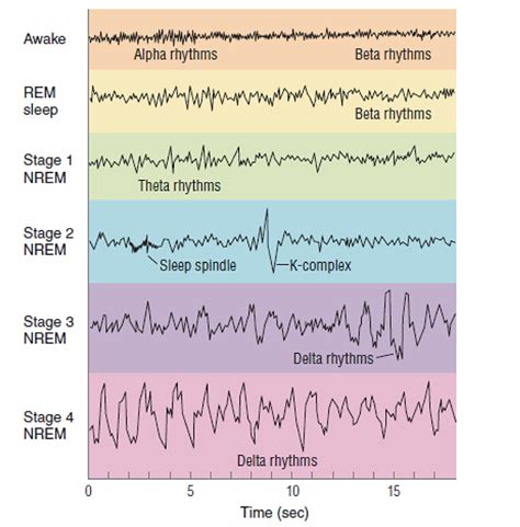 eeg recordings during rem sleep are similar to quizlet